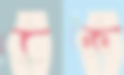王苏医生简介做手术价格
