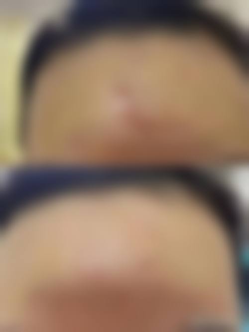 罗远洪医生做手术的价格情况