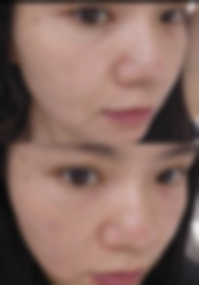 chois皮肤科医院新沙店口碑好不好？附真实患者口碑评价