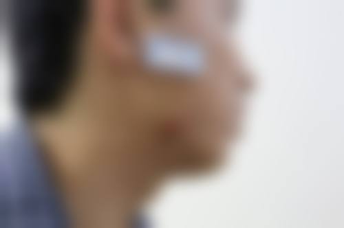 苏州帕丽斯整形医院口碑评价如何