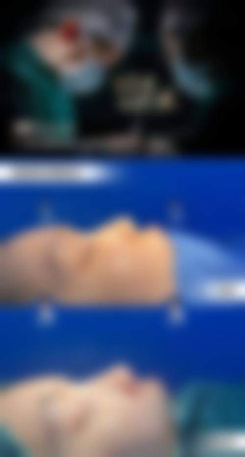 宁波江东邬立新医疗美容诊所更擅长什么手术
