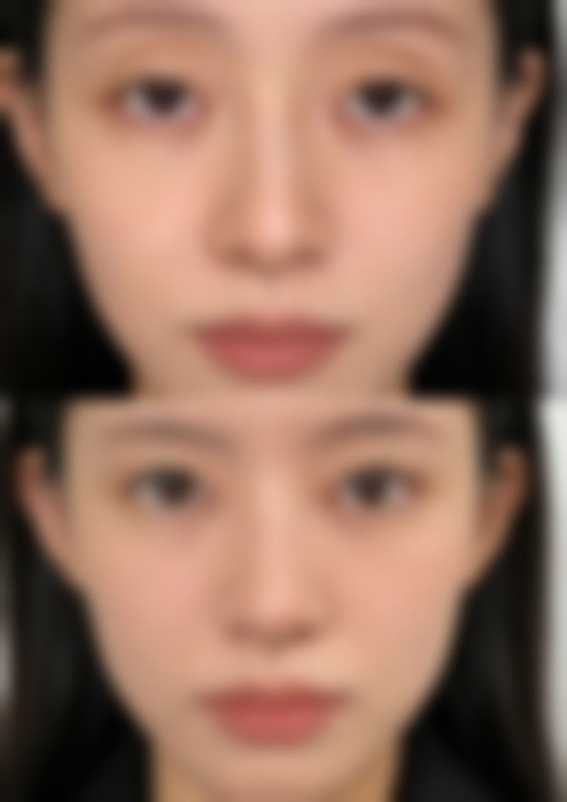 武汉斯启诺医疗美容的祛眼袋项目是否划算
