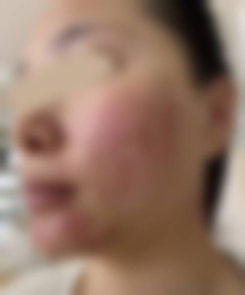 深圳鲍建勇医疗美容诊所更擅长什么手术