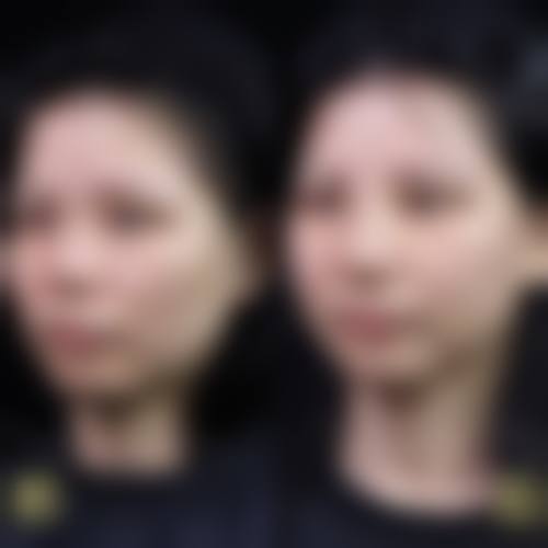 惠州百佳伊丽莎白妇产医院整形科价格表