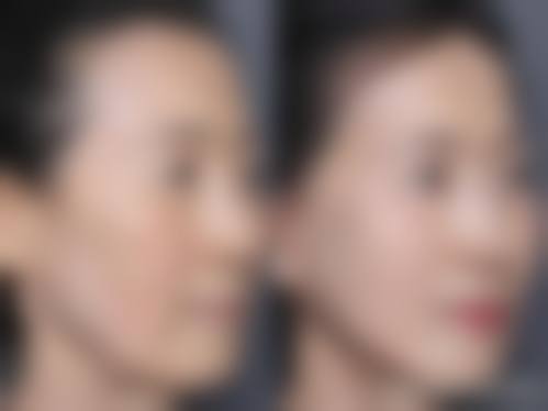 韩国Clinic10皮肤整形医院口碑评价