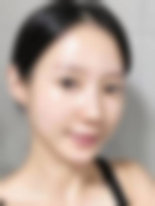 李王镇医生做手术价格