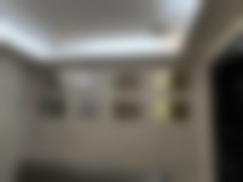韩国sage医院李敬秀医生纤腓针价格明细情况