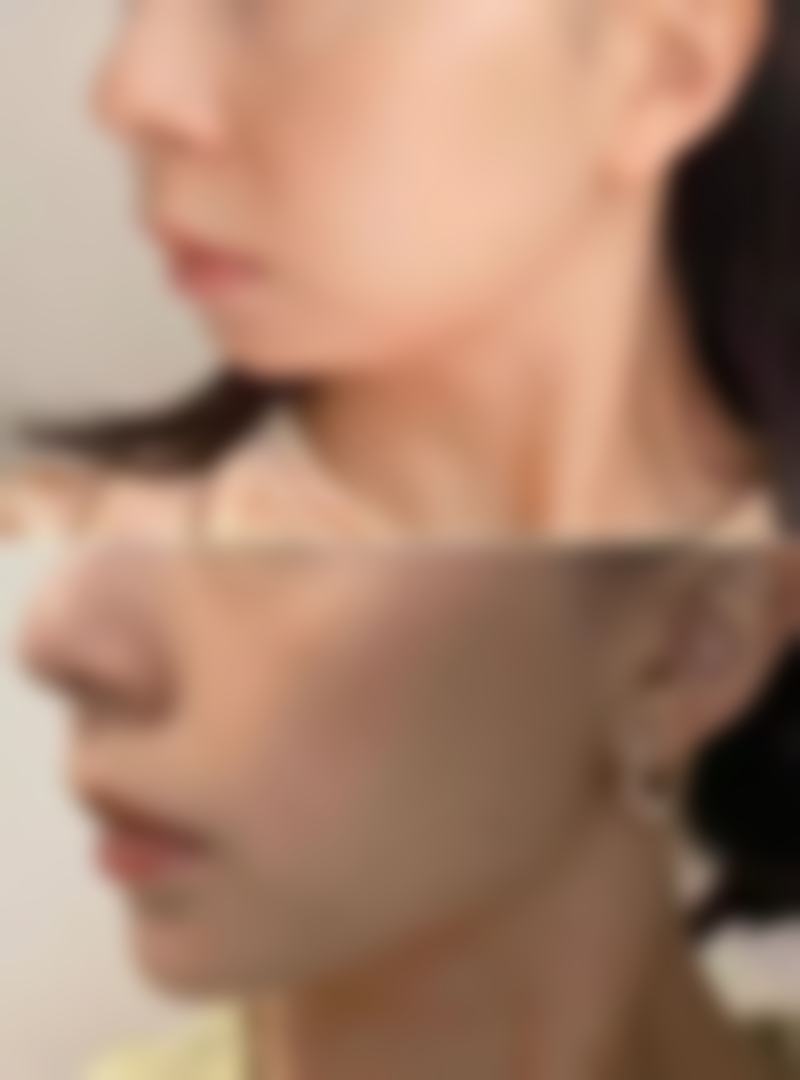 韩国雅佳整形外科 