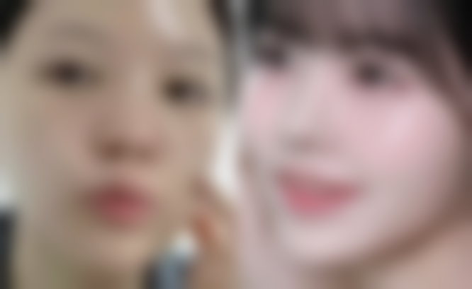 韩国雅佳整形外科 