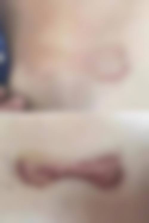 魏子医生做手术价格