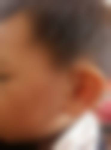 广州韩致整形医院项目特色