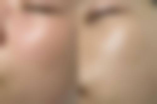 莫利香医生项目优势