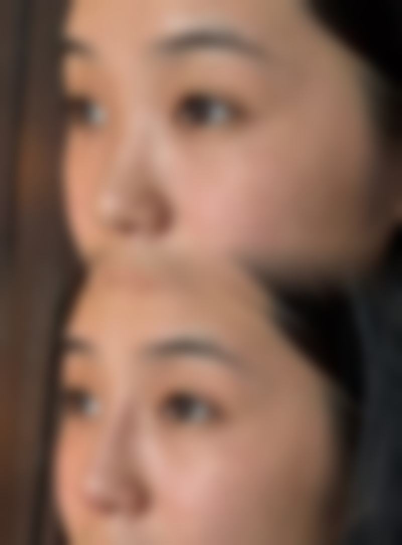 北京赵玉明整形医院口碑好不好