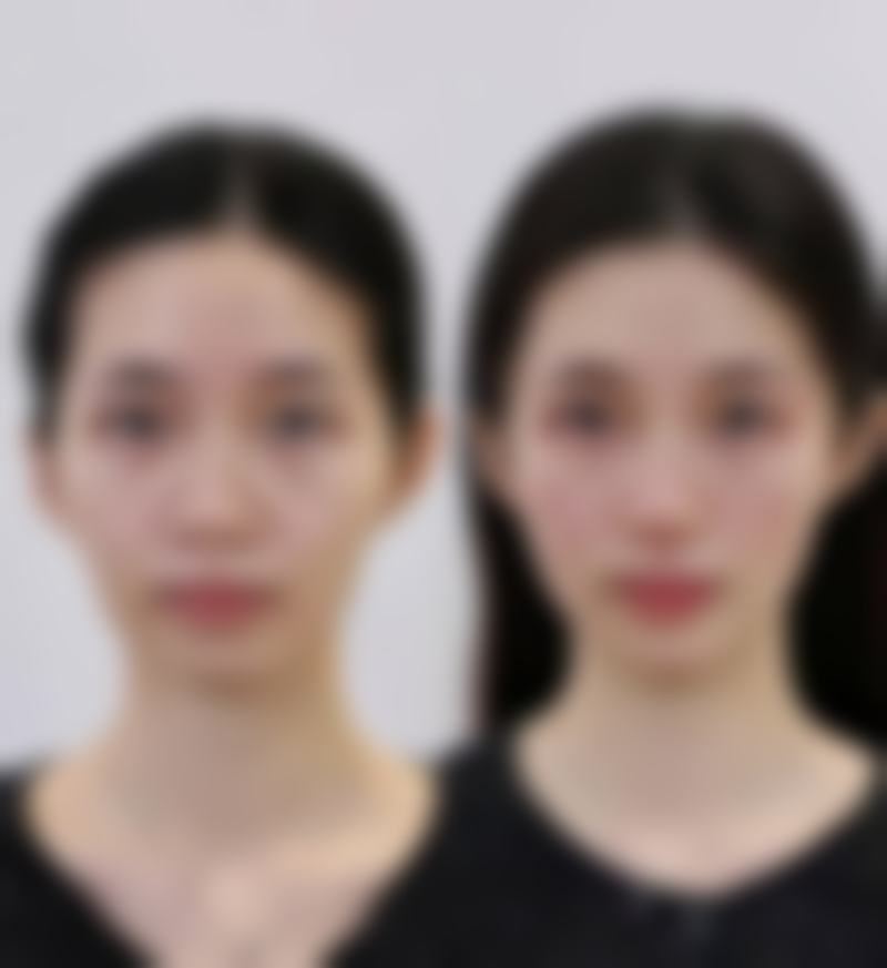 上海市哪家医美医院较便宜——上海时光里医疗美容医院