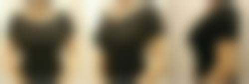 深圳明伦整形美容门诊部怎么样，有哪些特色项目