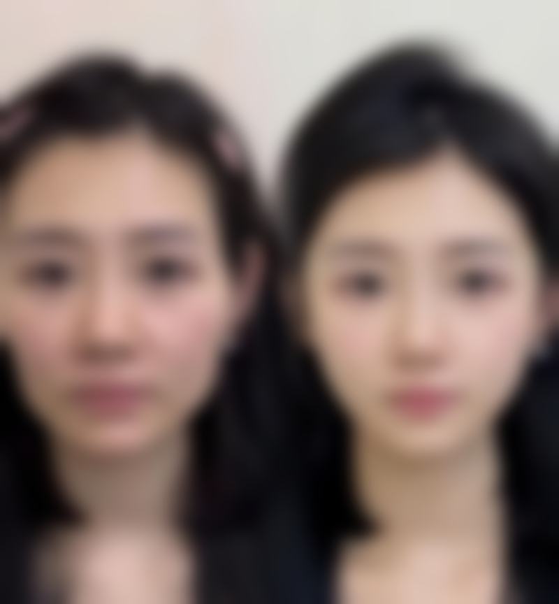 杨坤医生简介项目优势