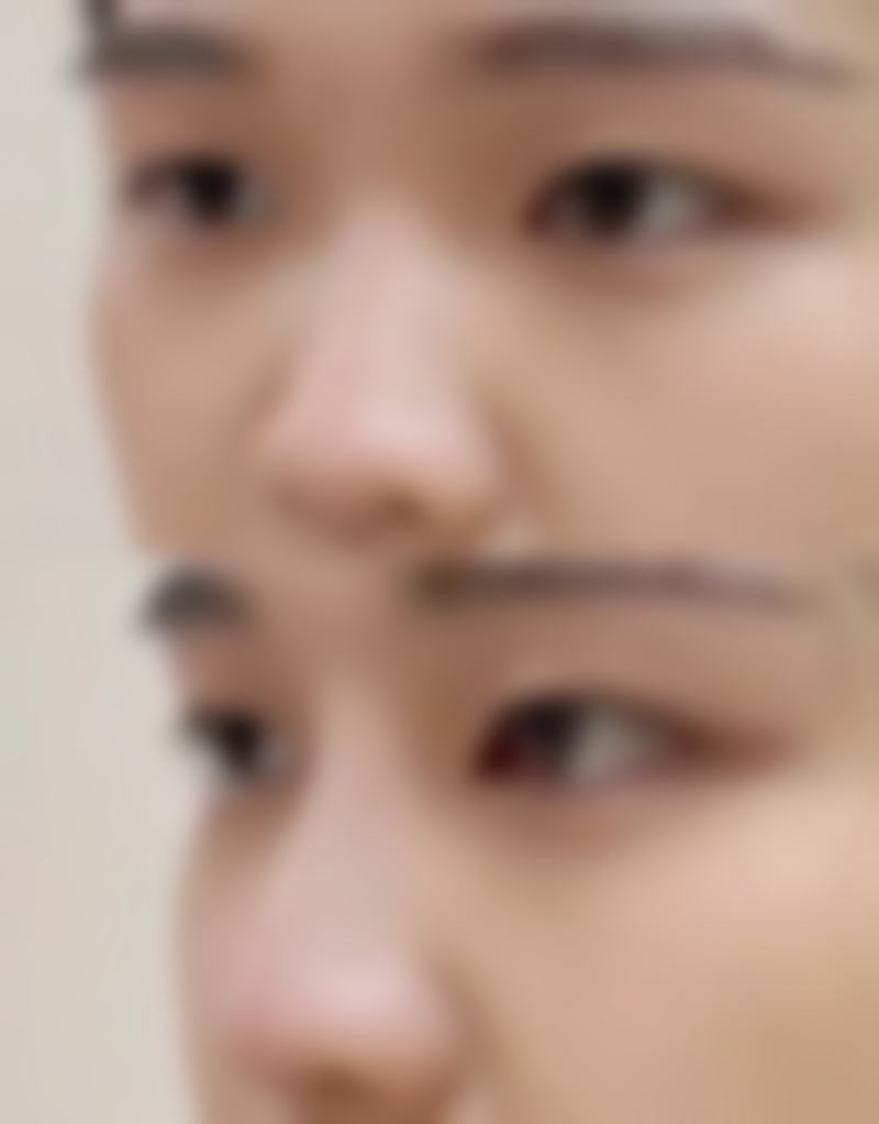 巴中如一整形医院价格表