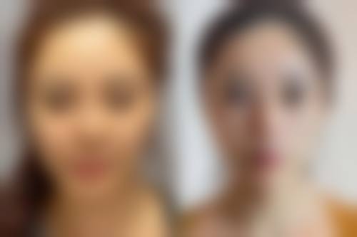 成都东方美相医学整形医院怎么样之价格表