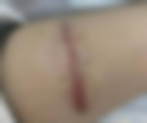 郑州颜图丽人整形医院口碑好不好:真实患者,好评不断