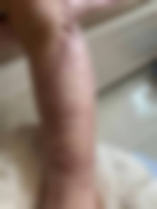 李越钢医生口碑如何