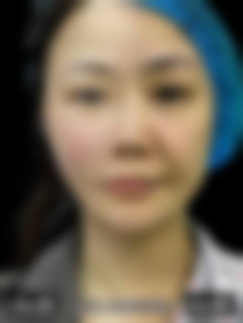 李越钢医生顾客实例图片