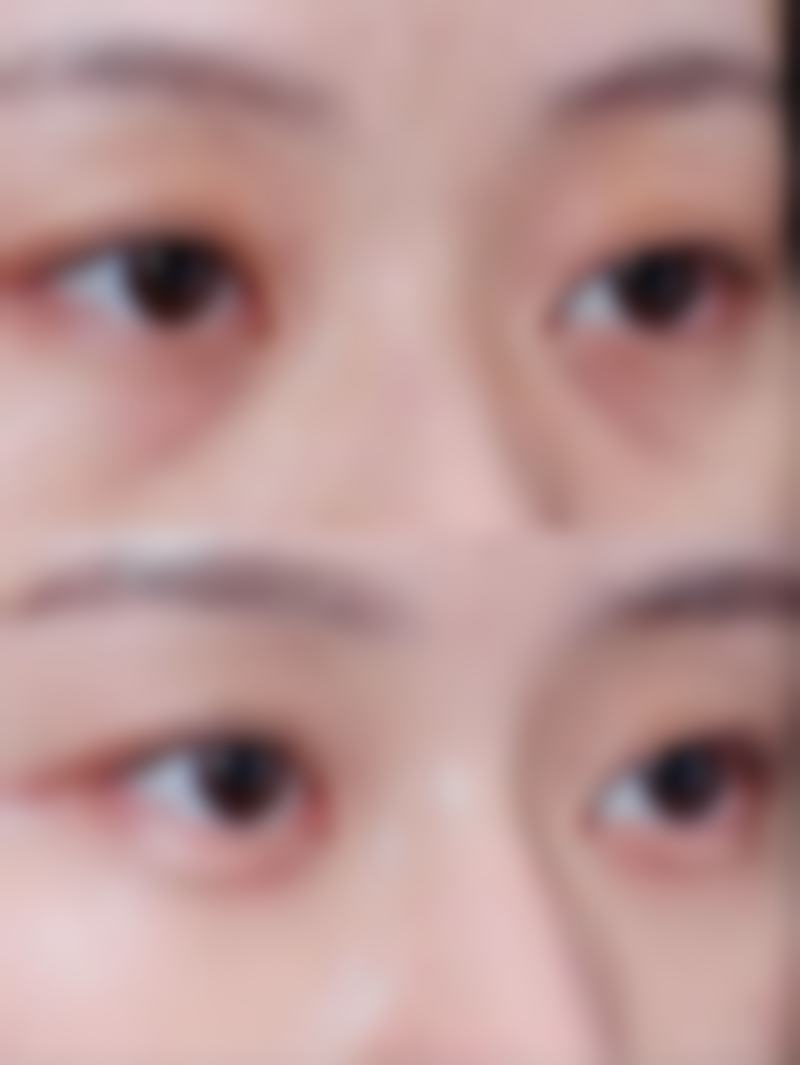 韩国皮肤科推荐之浪漫江南保护服务专精性