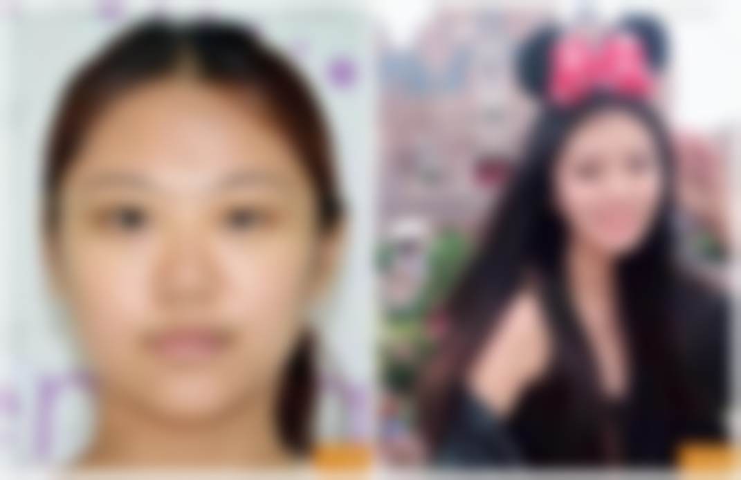 北京禾美嘉医疗美容门诊部预约挂号流程——北京米扬丽格医疗美容门诊部
