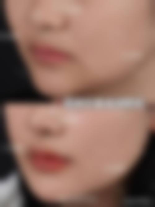 长沙晶肤医疗美容口碑好不好