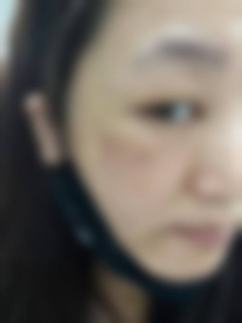 胡可斌医生顾客实例图片