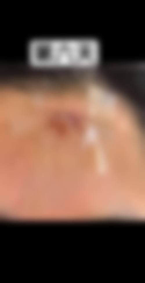 韩吉鉉医生项目优势