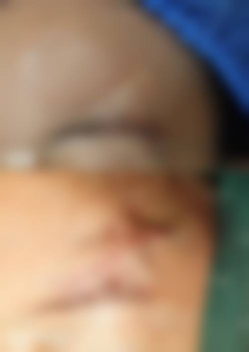 李进超医生项目优势