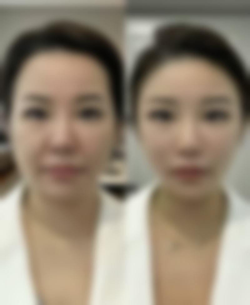 厦门欧韵医疗美容诊所的价格表