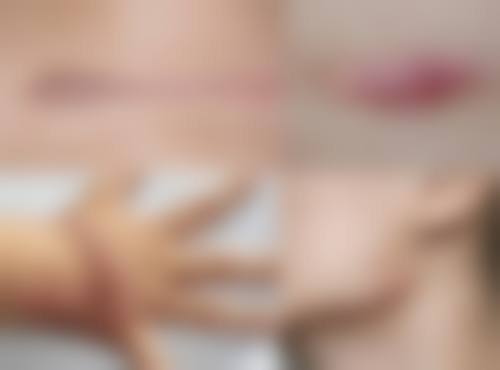 荔浦紫熙蜜心整形医院价格表