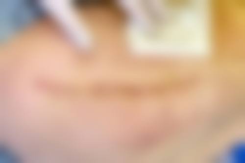 卿霞凤医生做手术价格