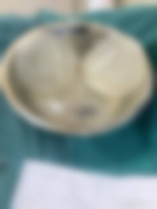 七、呼和浩特唯科整形医院真实患者口碑评价