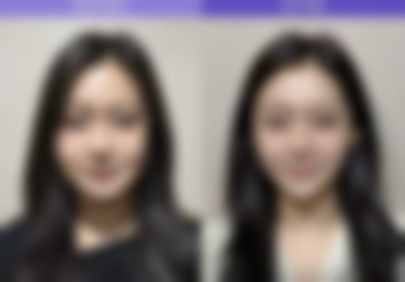 广西柏琳悦美医疗美容门诊部顾客实例