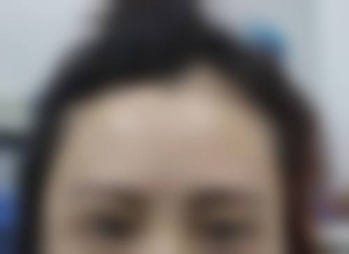 广东广州仁健植发抖音团购活动及价格表