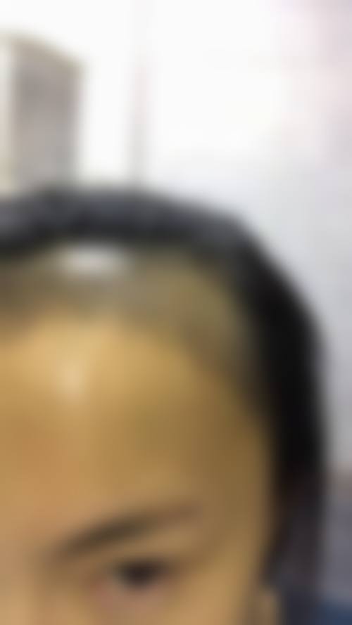 广东广州仁健植发正规吗