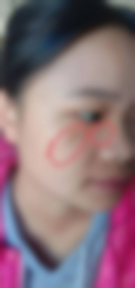 长沙李建平整形医院怎么样之价格表