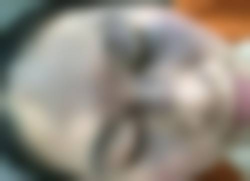 卢燕明医生简介项目优势