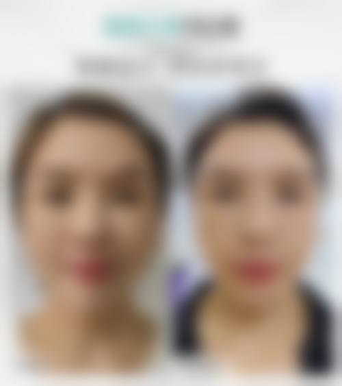 河南元哲医疗美容门诊部顾客实例