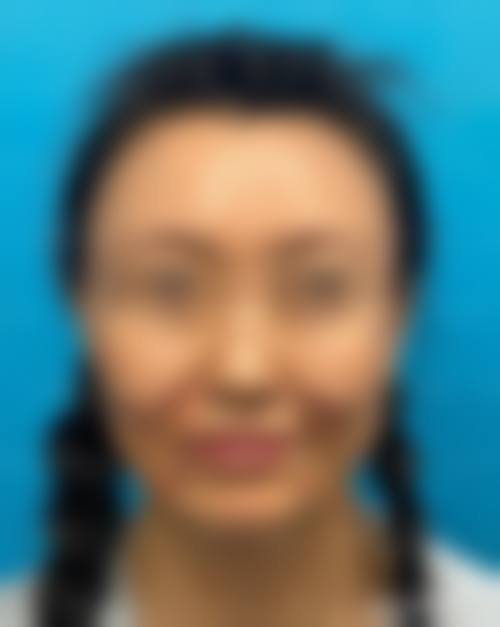 南宁首大医院医疗美容科怎么样——项目特色