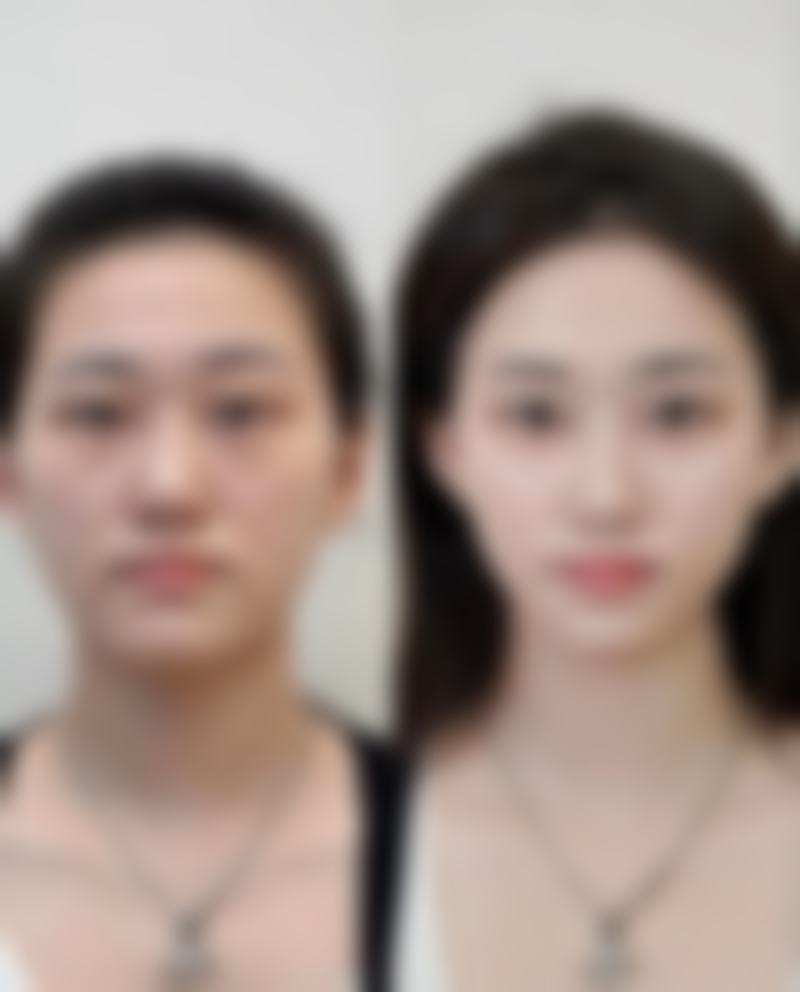 八、成都大华医学整形美容医院怎么样——价格表