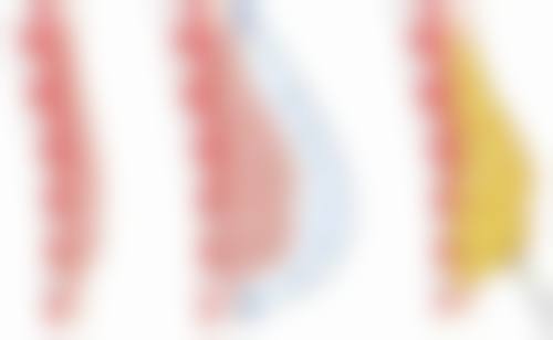王秀娟医生简介之项目优势