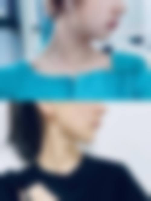 河南省军区直属医院激光美容中 心口碑好不好