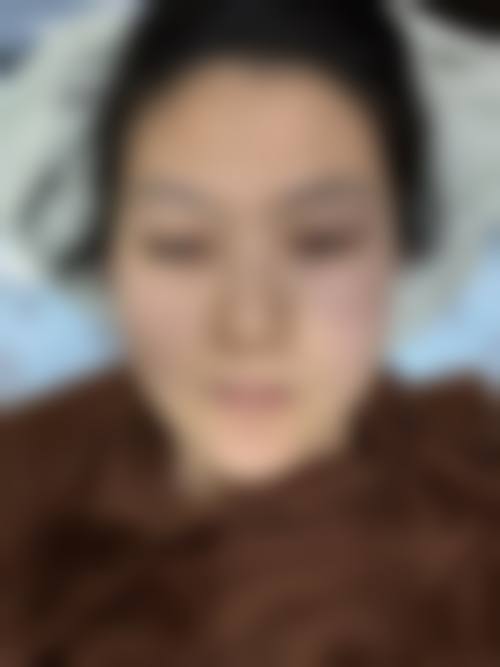 郑星勋医生顾客实例图片