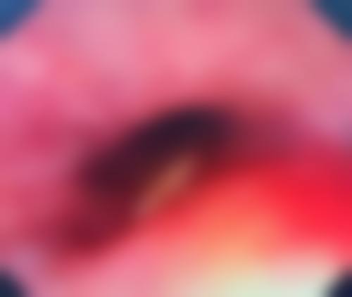 郑星勋医生口碑如何