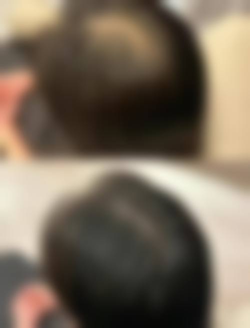 曾祥瑞医生简介口碑如何