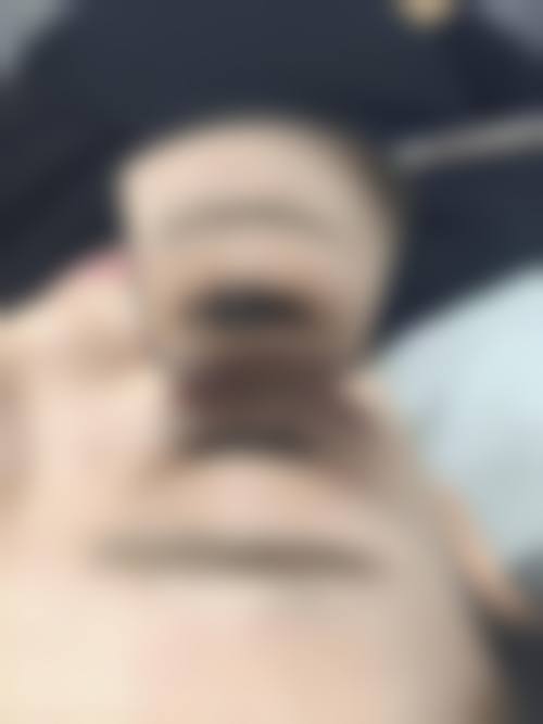 曾祥瑞医生简介做手术价格