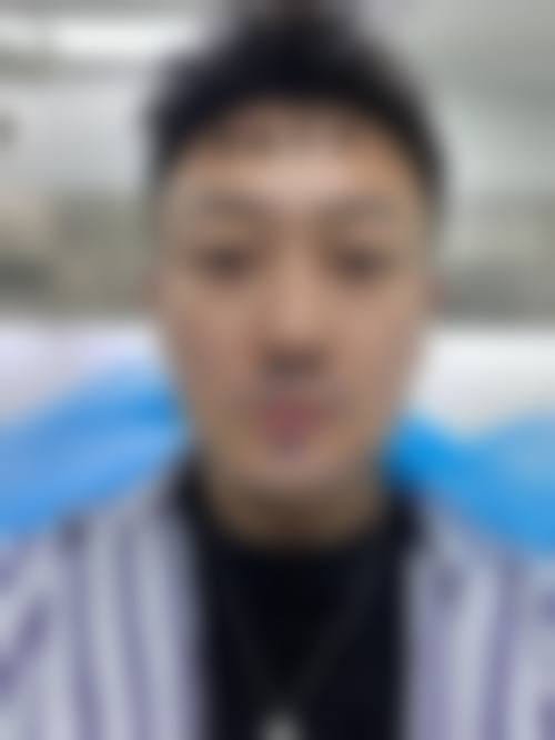 曾祥瑞医生简介项目优势